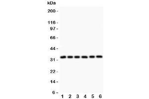 Western blot testing of MyD88 antibody and Lane 1:  rat heart;  2: human HeLa;  3: (h) MCF7;  4: (h) HEPG2;  5: (h) Jurkat;  6: (h) Raji. (MYD88 antibody  (AA 44-264))