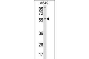 ETV5 Antibody (N-term) (ABIN1881325 and ABIN2838889) western blot analysis in A549 cell line lysates (35 μg/lane). (ETV5 antibody  (N-Term))