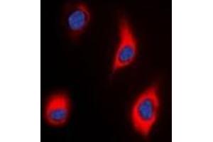 Immunofluorescent analysis of Tensin 3 staining in HeLa cells. (TNS3 antibody)
