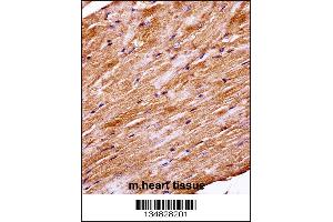 Mouse Mapk4 Antibody immunohistochemistry analysis in formalin fixed and paraffin embedded mouse heart tissue followed by peroxidase conjugation of the secondary antibody and DAB staining. (MAPK4 antibody  (N-Term))
