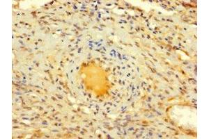 Immunohistochemistry of paraffin-embedded human ovarian tissue using ABIN7150017 at dilution of 1:100 (DIS3L2 antibody  (AA 201-400))