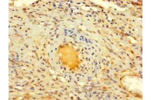 Immunohistochemistry of paraffin-embedded human ovarian tissue using ABIN7150017 at dilution of 1:100 (DIS3L2 antibody  (AA 201-400))