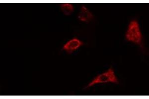 ABIN6274550 staining HepG2 cells by IF/ICC.