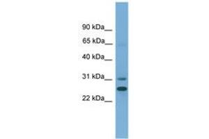 Image no. 1 for anti-Dehydrogenase/reductase (SDR Family) Member 2 (DHRS2) (AA 27-76) antibody (ABIN6745489) (DHRS2 antibody  (AA 27-76))