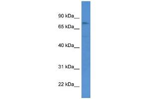 WB Suggested Anti-GSG2 Antibody Titration: 0. (GSG2 antibody  (Middle Region))
