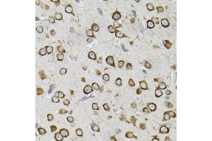 Immunohistochemistry of paraffin-embedded mouse brain using CEP164 antibody. (CEP164 antibody)