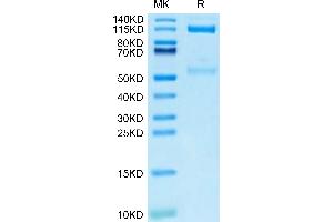 SDS-PAGE (SDS) image for Integrin alpha V, Integrin beta 3 (ITGAV/ITGB3) (AA 31-988) protein (Fc Tag) (ABIN7275076)