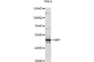 Western blot analysis of extracts of HeLa cells, using MIIP antibody (ABIN6293240) at 1:3000 dilution. (MIIP antibody)
