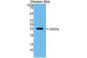 Detection of Recombinant DBP, Rat using Monoclonal Antibody to Vitamin D Binding Protein (DBP) (Vitamin D-Binding Protein antibody  (AA 209-394))