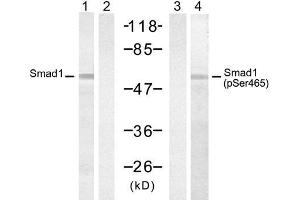 Western blot analysis of extract from 293 cells, untreated or treated with PMA (200nM, 30min), using Smad1 (Ab-465) Antibody (E021321, Lane 1 and 2) and Smad1 (Phospho-Ser465) Antibody (E011321, Lane 3 and 4). (SMAD1 antibody  (pSer465))