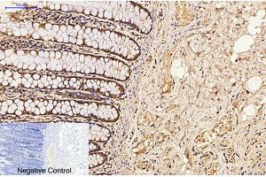 Immunohistochemical analysis of paraffin-embedded human colon tissue. (CDX2 antibody)