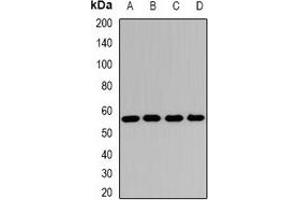 Western blot analysis of SCOT expression in Hela (A), Jurkat (B), mouse heart (C), rat kidney (D) whole cell lysates. (OXCT1 antibody)