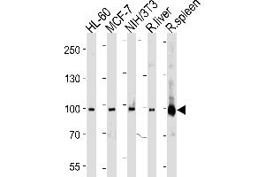 Western blot analysis in HL-60,MCF-7,mouse NIH/3T3 cell line, rat liver and spleen lysates (35ug/lane).