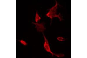 ABIN6266541 staining NIH-3T3 by IF/ICC. (FLI1 antibody  (Internal Region))