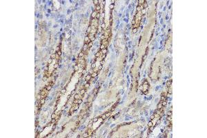 Immunohistochemistry of paraffin-embedded rat spleen using [KO Validated] Heme Oxygenase 1 (HO-1/HMOX1) Rabbit pAb (ABIN6131781, ABIN6141881, ABIN6141883 and ABIN6215065) at dilution of 1:50 (40x lens). (HMOX1 antibody  (AA 1-288))