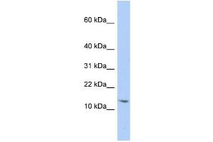 WB Suggested Anti-SNRPD2 Antibody Titration:  0. (SNRPD2 antibody  (N-Term))