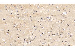 Immunohistochemistry (IHC) image for anti-Interleukin 6 Signal Transducer (Gp130, Oncostatin M Receptor) (IL6ST) (AA 392-566) antibody (ABIN7430552)