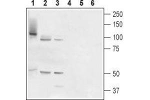 Western blot analysis of rat prostate (lanes 1 and 4), testis (lanes 2 and 5) and placenta (lanes 3 and 6): - 1-3. (TMC6 antibody  (Cytosolic, Intracellular))