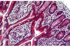 Human Small Intestine: Formalin-Fixed, Paraffin-Embedded (FFPE) (EPH Receptor B6 antibody  (AA 831-843))