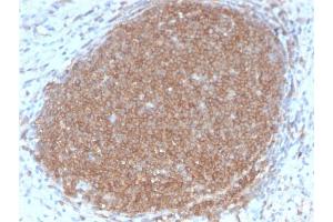 Immunohistochemistry (IHC) image for anti-Protein tyrosine Phosphatase, Receptor Type, C (PTPRC) antibody (ABIN6940470)