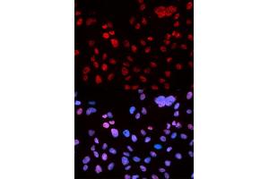 Immunofluorescence analysis of U2OS cells using Phospho-p53-S9 antibody.