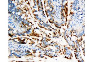 Anti-APE1 antibody, IHC(P) IHC(P): Rat Intestine Tissue (APEX1 antibody  (Middle Region))