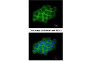 ICC/IF Image Immunofluorescence analysis of methanol-fixed A431, using SEC61A1, antibody at 1:200 dilution. (SEC61A1 antibody  (C-Term))