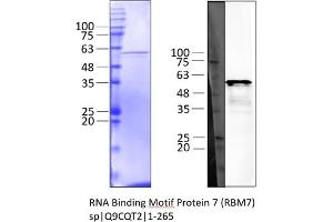 Western Blotting (WB) image for RNA Binding Motif Protein 7 (RBM7) (AA 1-265) protein (Strep Tag) (ABIN3144330) (RBM7 Protein (AA 1-265) (Strep Tag))