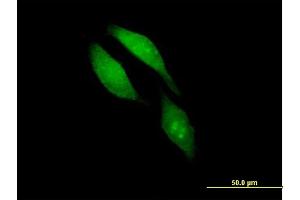 Immunofluorescence of purified MaxPab antibody to BRCC3 on HeLa cell. (BRCC3 antibody  (AA 1-316))