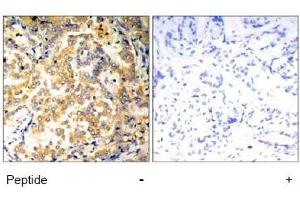 Image no. 1 for anti-Nuclear Factor of kappa Light Polypeptide Gene Enhancer in B-Cells 2 (NFKB2) (Ser871) antibody (ABIN197572)