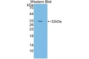 Detection of Recombinant LIPG, Mouse using Polyclonal Antibody to Lipase, Endothelial (LIPG) (LIPG antibody  (AA 115-369))