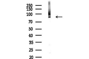 anti-ATPase, Ca++ Transporting, Cardiac Muscle, Fast Twitch 1 (ATP2A1) (Internal Region) antibody