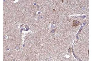 ABIN6268757 at 1/100 staining human brain tissue sections by IHC-P. (FBLN4 antibody  (Internal Region))