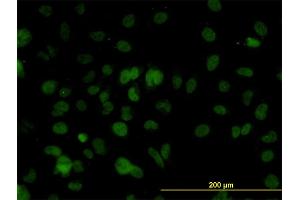 Immunofluorescence of monoclonal antibody to SMARCD2 on HeLa cell. (SMARCD2 antibody  (AA 398-474))