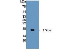 Detection of Recombinant BPI, Mouse using Polyclonal Antibody to Bactericidal/Permeability Increasing Protein (BPI) (BPI antibody  (AA 320-457))