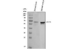 Western blot analysis of Zebrafish CCT5 using anti-Zebrafish CCT5 antibody (AZQ6NVI6).