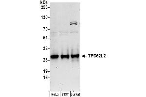 anti-Tumor Protein D52-Like 2 (TPD52L2) (AA 156-206) antibody