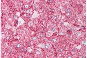 Human Liver (formalin-fixed, paraffin-embedded) stained with MINK1 antibody ABIN213551 at 5 ug/ml followed by biotinylated goat anti-rabbit IgG secondary antibody ABIN481713, alkaline phosphatase-streptavidin and chromogen. (MAP4K6 antibody  (Internal Region))