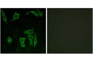 Immunofluorescence analysis of LOVO cells, using GRM5 Antibody. (Metabotropic Glutamate Receptor 5 antibody  (AA 21-70))