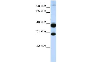 WB Suggested Anti-ZNF138 Antibody Titration:  0. (ZNF138 antibody  (C-Term))