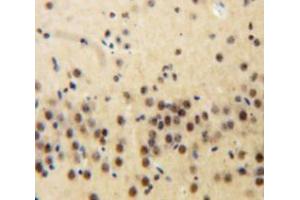 Used in DAB staining on fromalin fixed paraffin-embedded Brain tissue (Plakophilin 2 antibody  (AA 571-849))