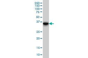 FHL1 monoclonal antibody (M01), clone 2A9. (FHL1 antibody  (AA 23-120))