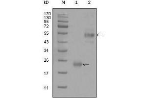 Western blot analysis using CD44 mouse mAb against truncated Trx-CD44 recombinant protein (1) and GST-CD44 (aa628-699) recombinant protein (2). (CD44 antibody)