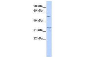 Image no. 1 for anti-Zinc Finger Protein 765 (ZNF765) (AA 288-337) antibody (ABIN6741084)