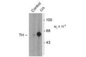 Image no. 1 for anti-Tyrosine Hydroxylase (TH) (pSer31) antibody (ABIN227933) (Tyrosine Hydroxylase antibody  (pSer31))