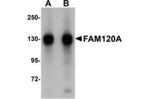 Western blot analysis of FAM120A in SK-N-SH cell lysate with AP30329PU-N FAM120A antibody at (A) 0. (FAM120A antibody  (Center))