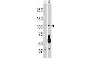 The MAP3K14 polyclonal antibody  is used in Western blot to detect MAP3K14 in 293 cell lysate (Lane 1) and rat testis tissue lysate (Lane 2) . (MAP3K14 antibody  (AA 126-155))