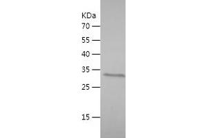 Western Blotting (WB) image for SWI/SNF Related, Matrix Associated, Actin Dependent Regulator of Chromatin, Subfamily A-Like 1 (SMARCAL1) (AA 683-954) protein (His-IF2DI Tag) (ABIN7283892) (SMARCAL1 Protein (AA 683-954) (His-IF2DI Tag))