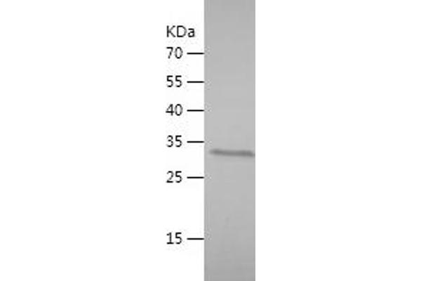 SMARCAL1 Protein (AA 683-954) (His-IF2DI Tag)
