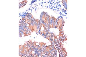 Immunohistochemistry of paraffin-embedded Human colon carcinoma using CGN Rabbit pAb (ABIN7266400) at dilution of 1:100 (40x lens). (Cingulin antibody  (AA 904-1203))